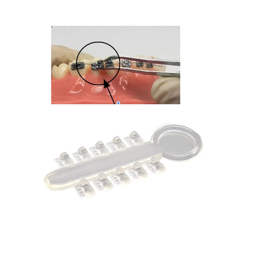Orthodontic rotation wedges (view 3) by ISSC Odont