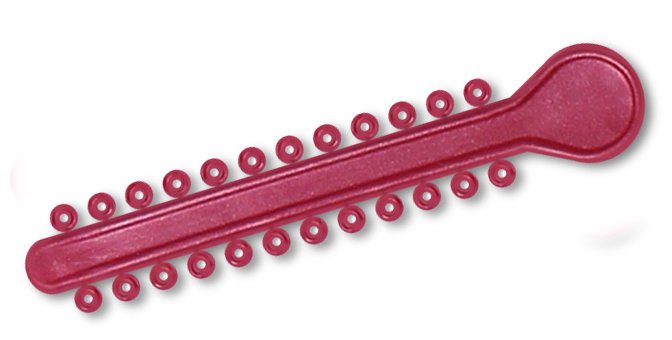 Bright red pearl elastic ligature ties for braces