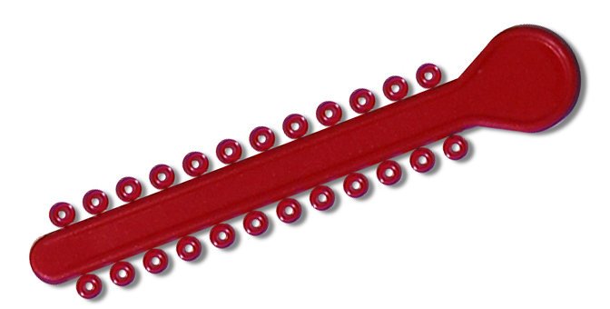Bright red elastic ligature ties for braces