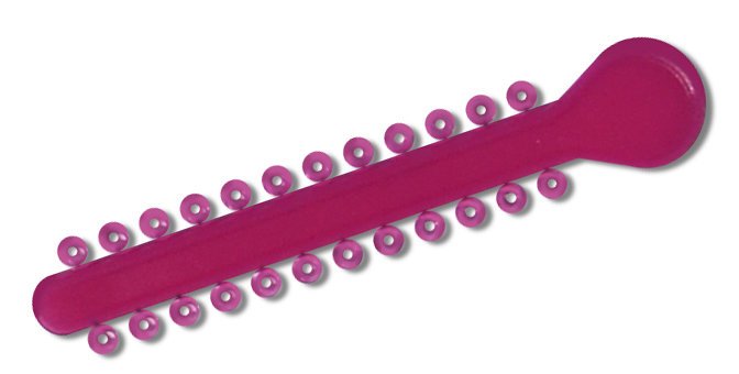 Hot pink elastic ligature ties for braces