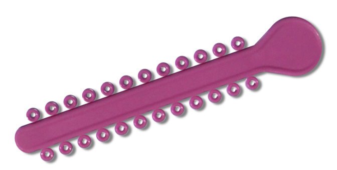 Light pink elastic ligature ties for braces