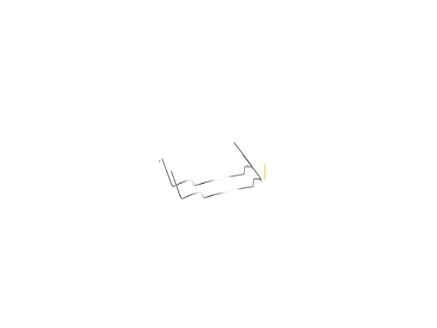 Orthodontic intrusion arch wire (view 2) by ISSC Odont