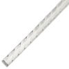 Lingual Retention Wires - Image 2